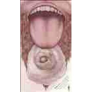 gentle giant: scraping the barrel